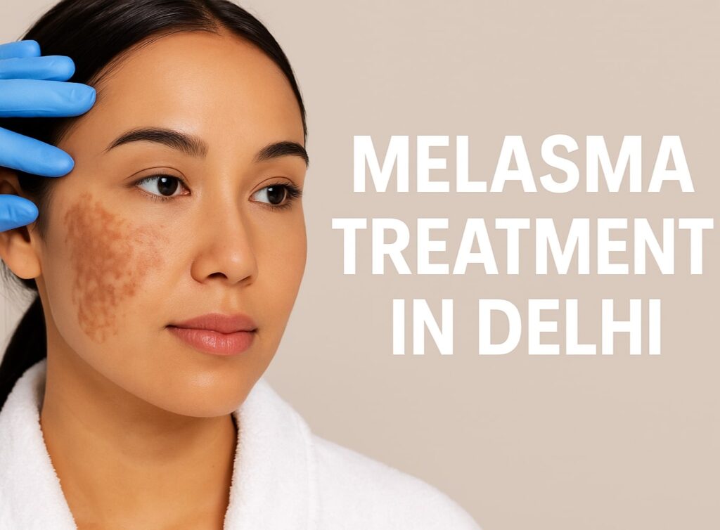 Melasma Treatment in Delhi
