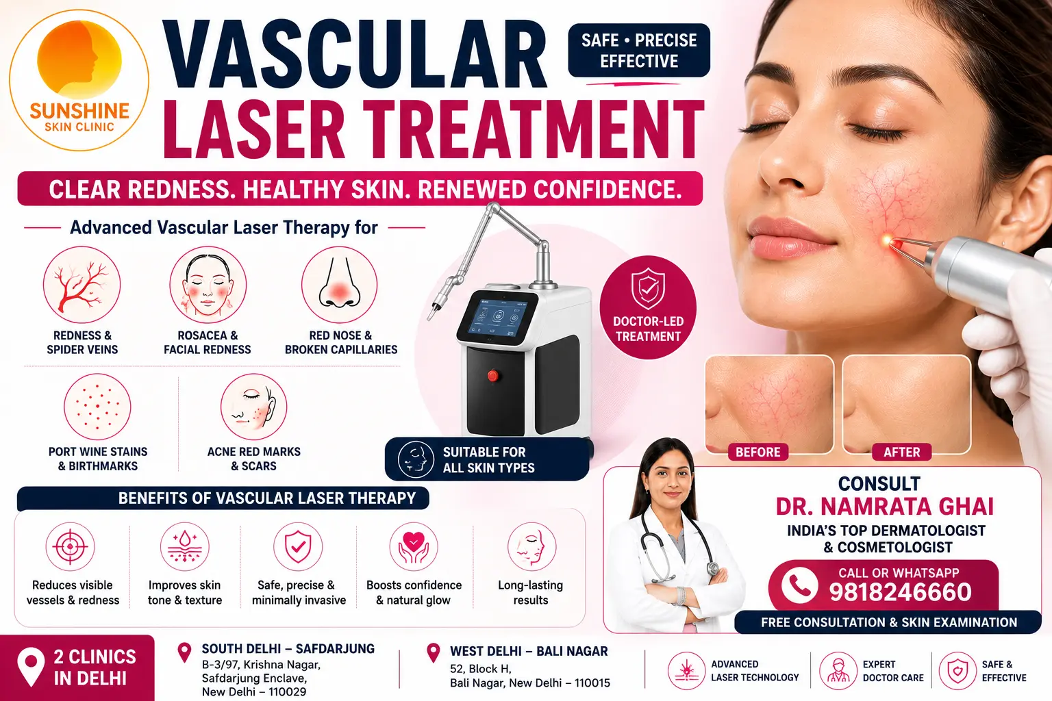 Vascular laser treatment at Sunshine Skin Clinic